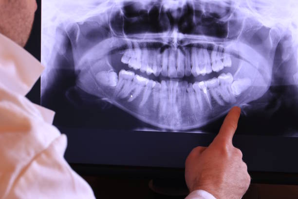 Best Emergency Dental Surgery in Davis, OK