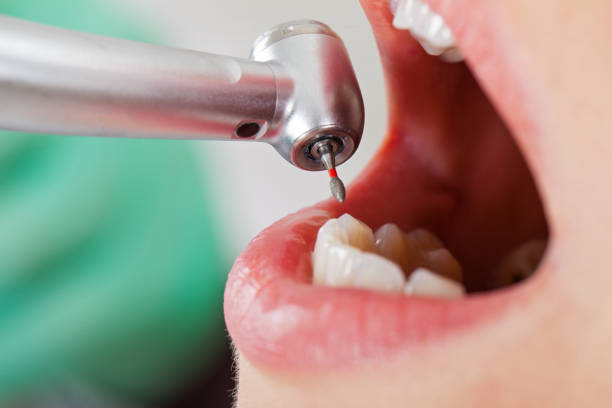 Best Emergency Orthodontic Repairs in Davis, OK